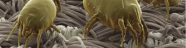 Blepharitis and Dry Eyes- Dr. Calotti - Great Lakes Eye Centre in ...